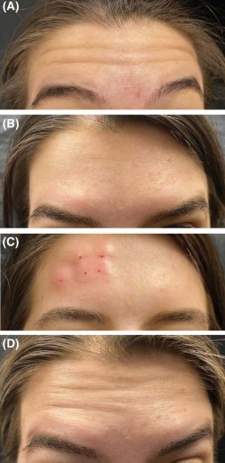 Figure 1 from publication